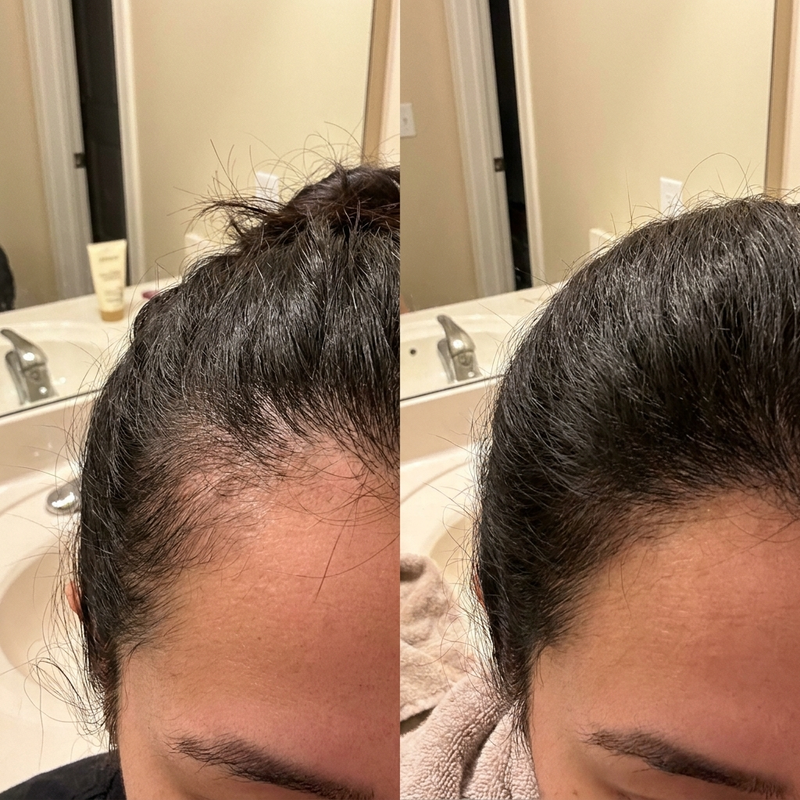 Priya · 36 · 7 months postpartum